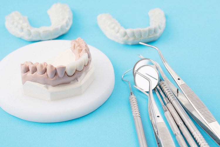 بریج دندان برای چه کسانی مناسب است؟