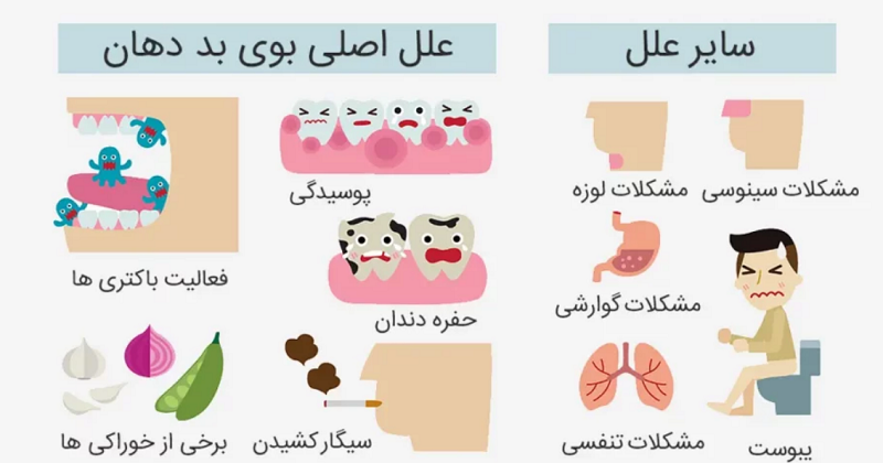 دلایل بوی نامطبوع دهان