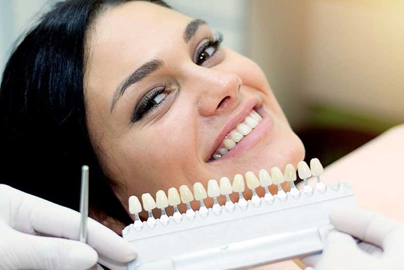 علت تفاوت قیمت کامپوزیت دندان با لمینت 